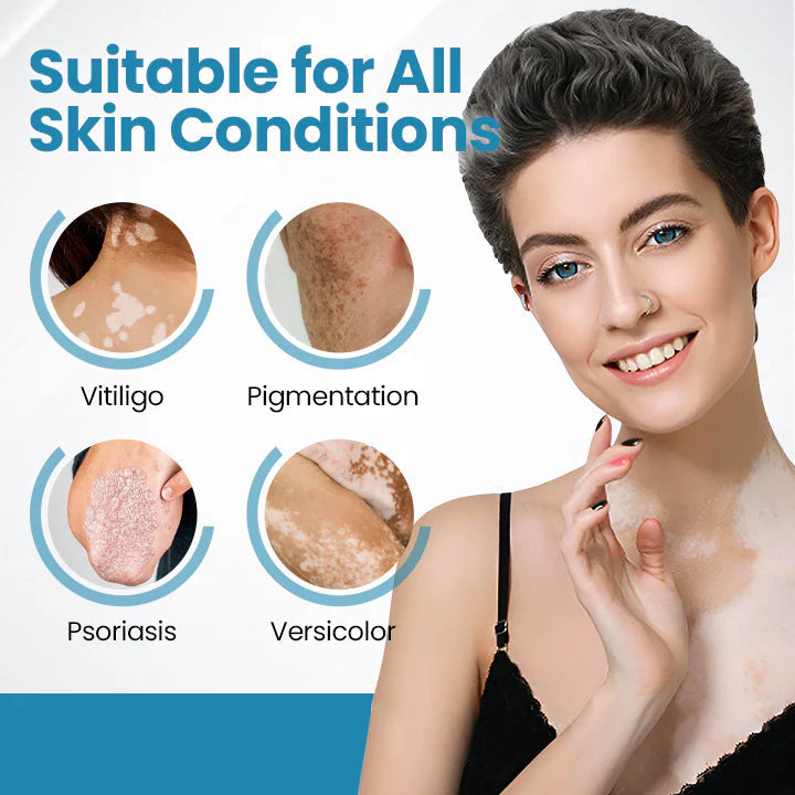 💥Biikenda® DermaBeam Vitiligo Therapy Device⏳Limited-time 49% off⏰💥