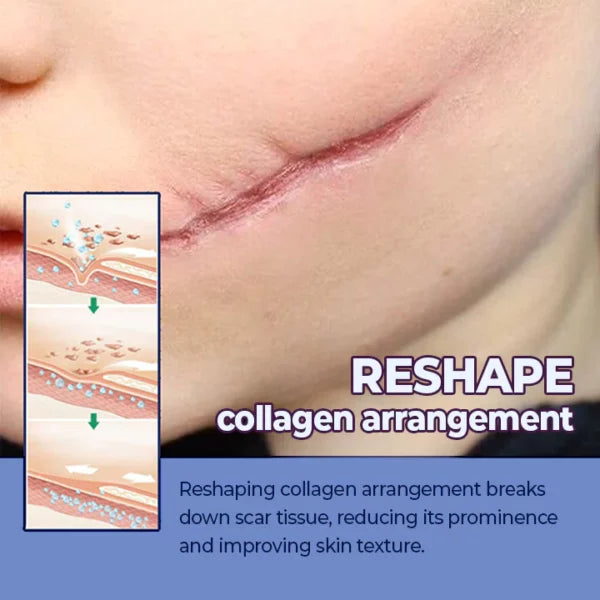 ScarFade™ UV Phototherapy Scar Removal Pen