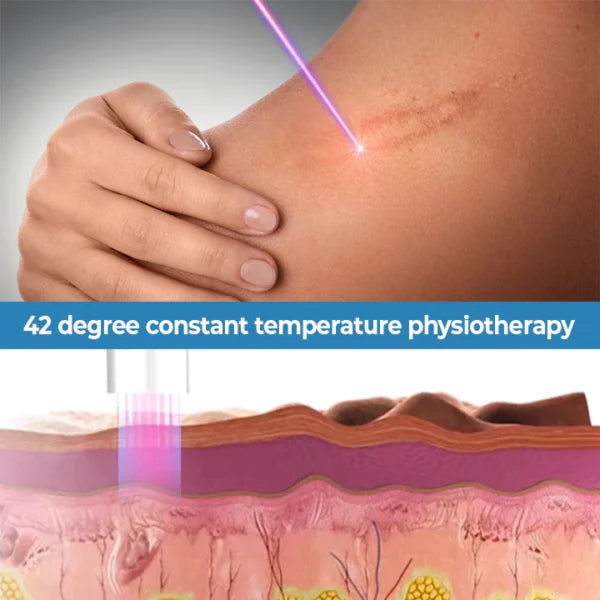ScarFade™ UV Phototherapy Scar Removal Pen